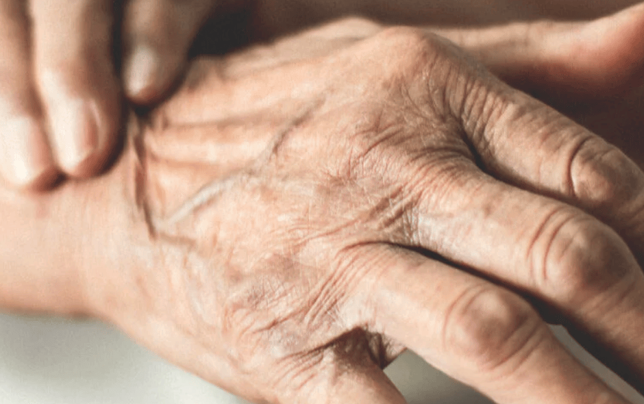 Image of an elderly person holding their wrist, in pain.